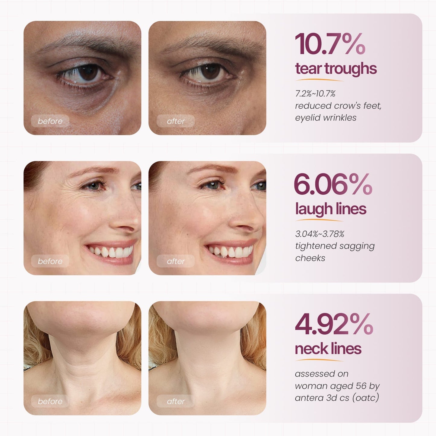 Clarifying Calcium Multi Balm Stick