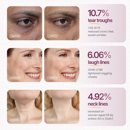 Clarifying Calcium Multi Balm Stick